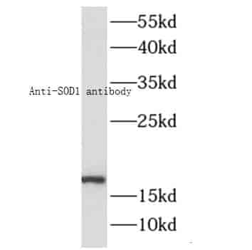 Anti-SOD1 antibody